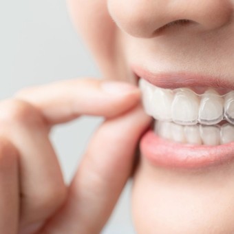 invisalign icon