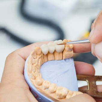 dental bridges icon