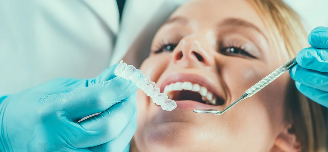 invisalign carrollwood