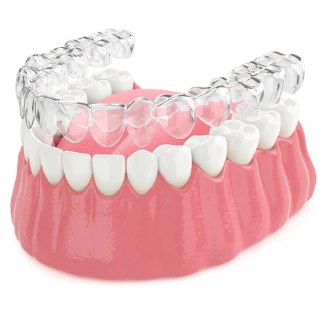Our invisalign in Carrollwood