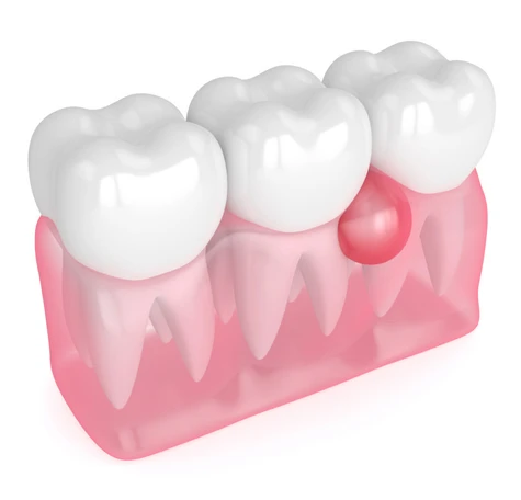 periodontics near you