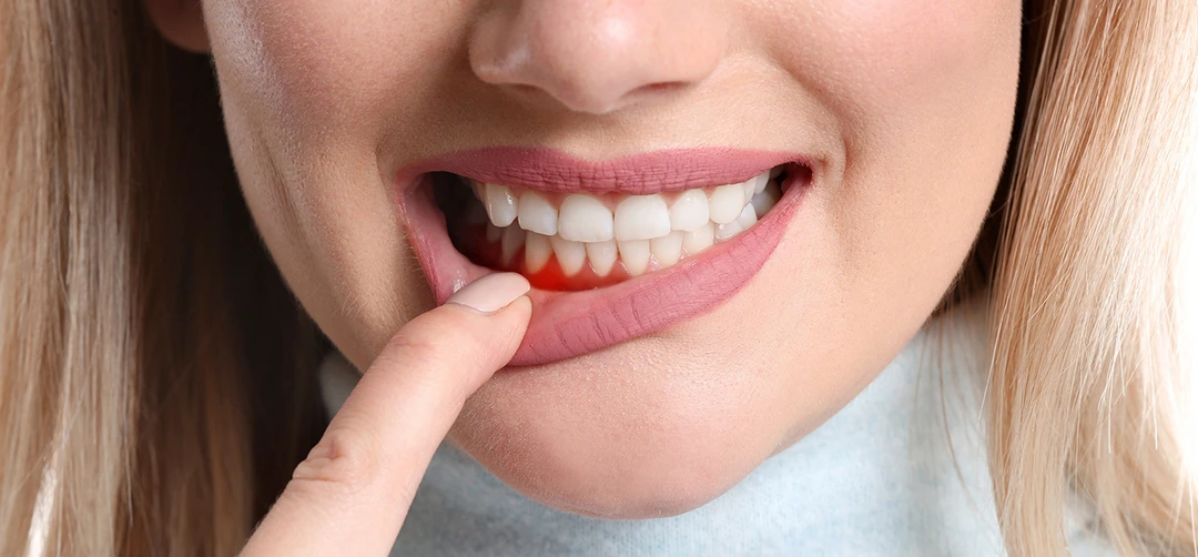 periodontal services carrollwood