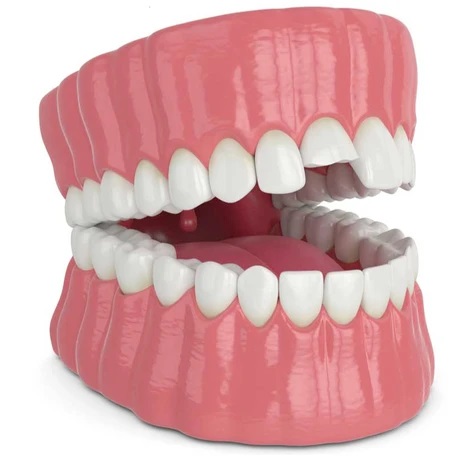 smile makeover