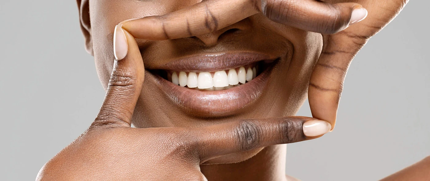 teeth whitening near you