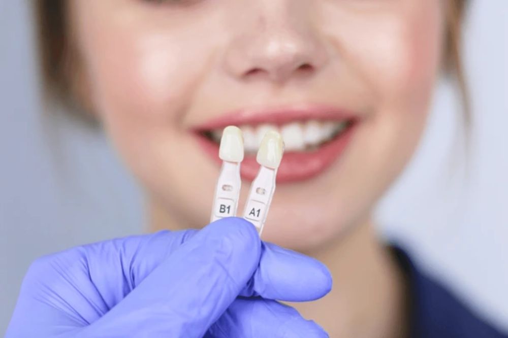 can veneers fix crooked teeth understanding the possibilities