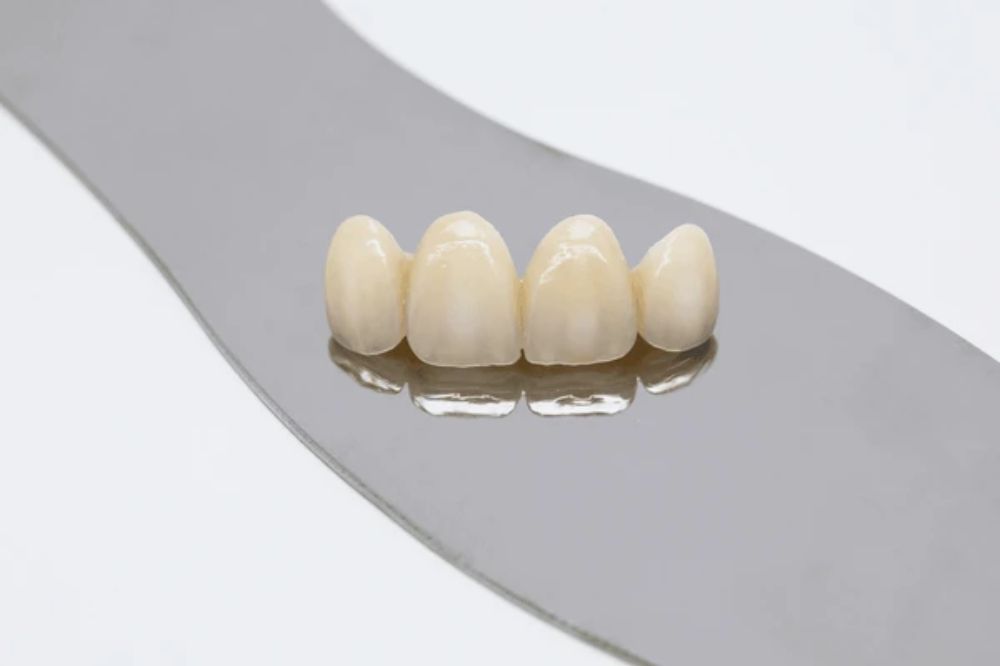the benefits of dental bridges restoring your smile and confidence